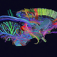 Illustration for article titled Amazing DSI Brain Scanning Visualizes Your Minds Inner Workings In 3D